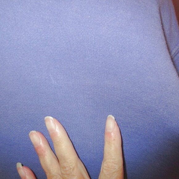 Grateful Dead Head Sweatshirt Size M Psychedelic Groovy Grunge Urban Outfitters - Picture 9 of 12